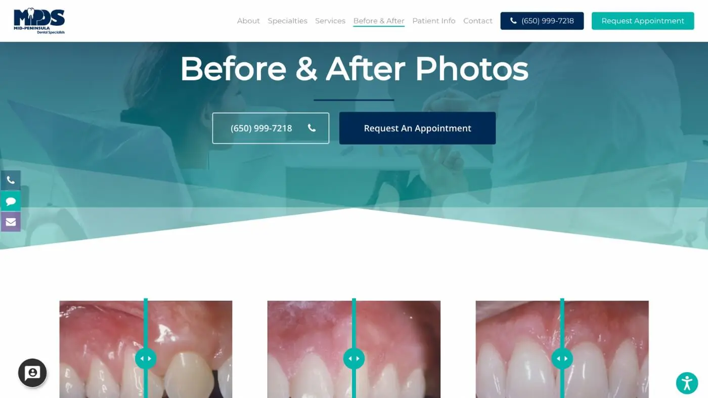 MPDS Screenshot 4 Screenshot of Mid Peninsula Dental Specialists’ “Before & After Photos” page, featuring a slider to compare dental results with close-up images of teeth and gums. The navigation menu and contact info are displayed at the top.